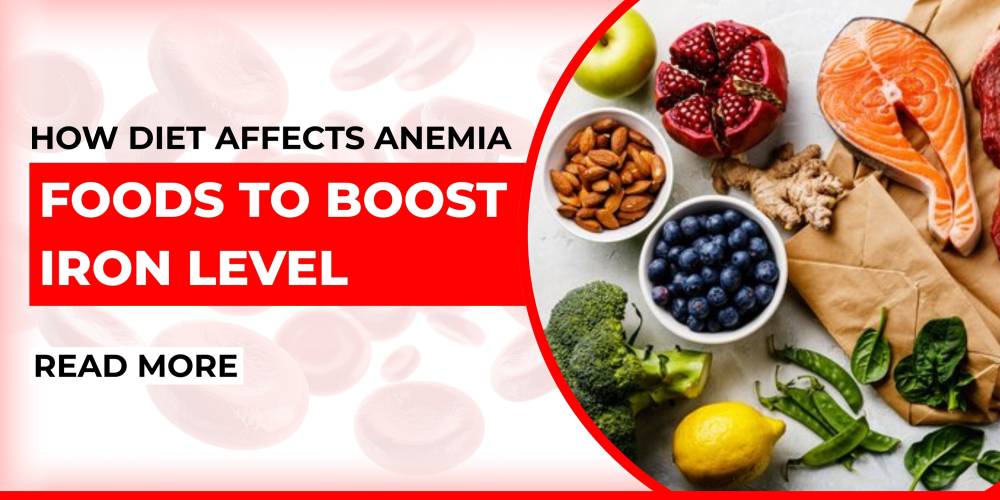 How Diet Affects Anemia: Foods to Boost Iron Levels
