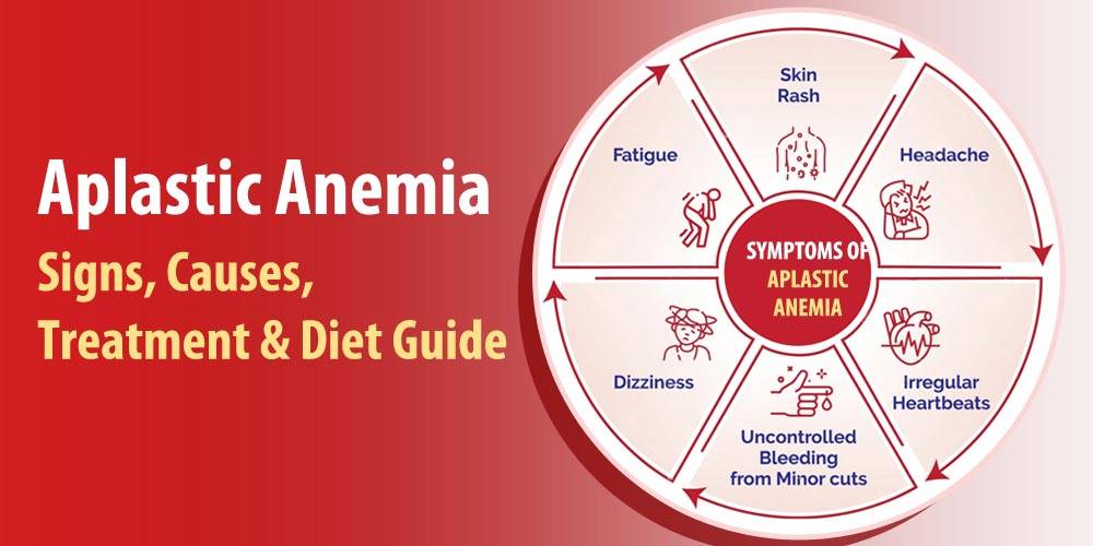 What Is Aplastic Anemia - Warning Signs, Causes & How It’s Treated