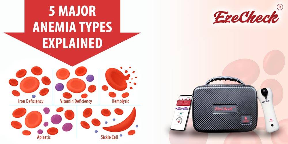 Top 5 Major Anemia Types: A Guide to Causes, Symptoms & Treatment
